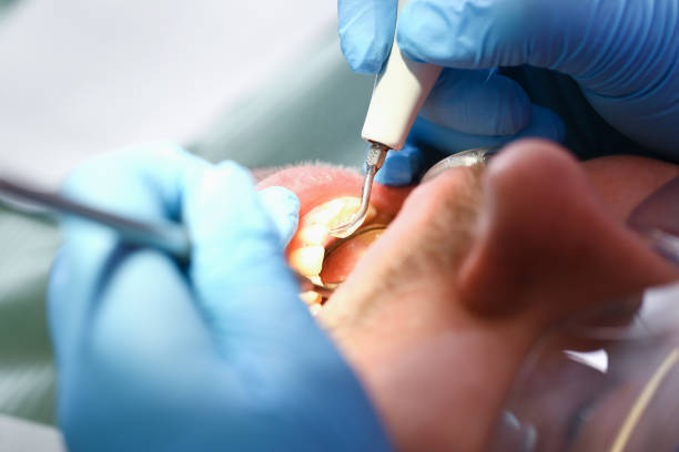 Best Emergency Treatment for Dental Infections or Abscesses in Mascot, TN