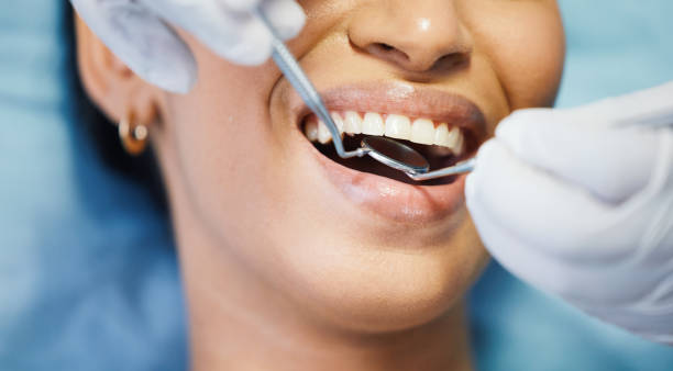 Best Emergency Dental Care for Broken or Chipped Teeth in Mascot, TN